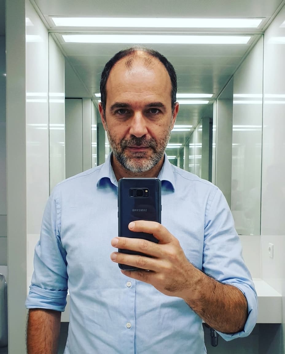 Avant — Peter, 47 — 20 semaines